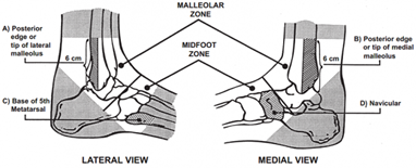 Ottawa Ankle and Foot Rules